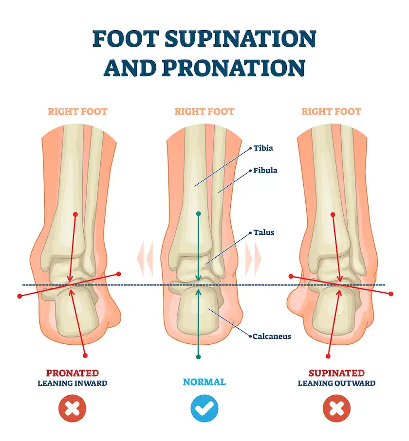 Supination in feet and exercises to correct it