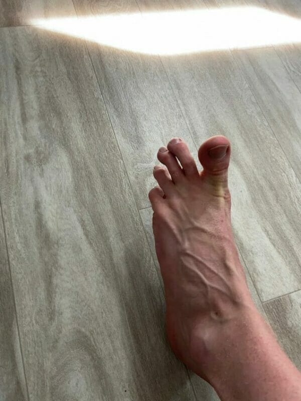 sprained toe exercise: toe splay